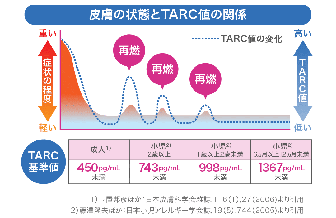 皮膚の炎症が重いとTARC検査の数値が高くなり、