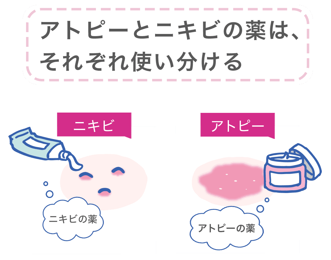 アトピーとニキビの薬は、それぞれ使い分ける